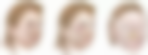 真凸嘴和假凸嘴的区别