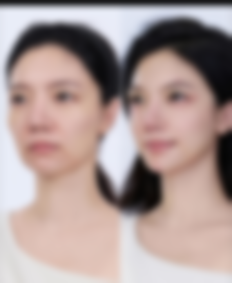总结——保定芳华丽格医疗美容诊所怎么样？