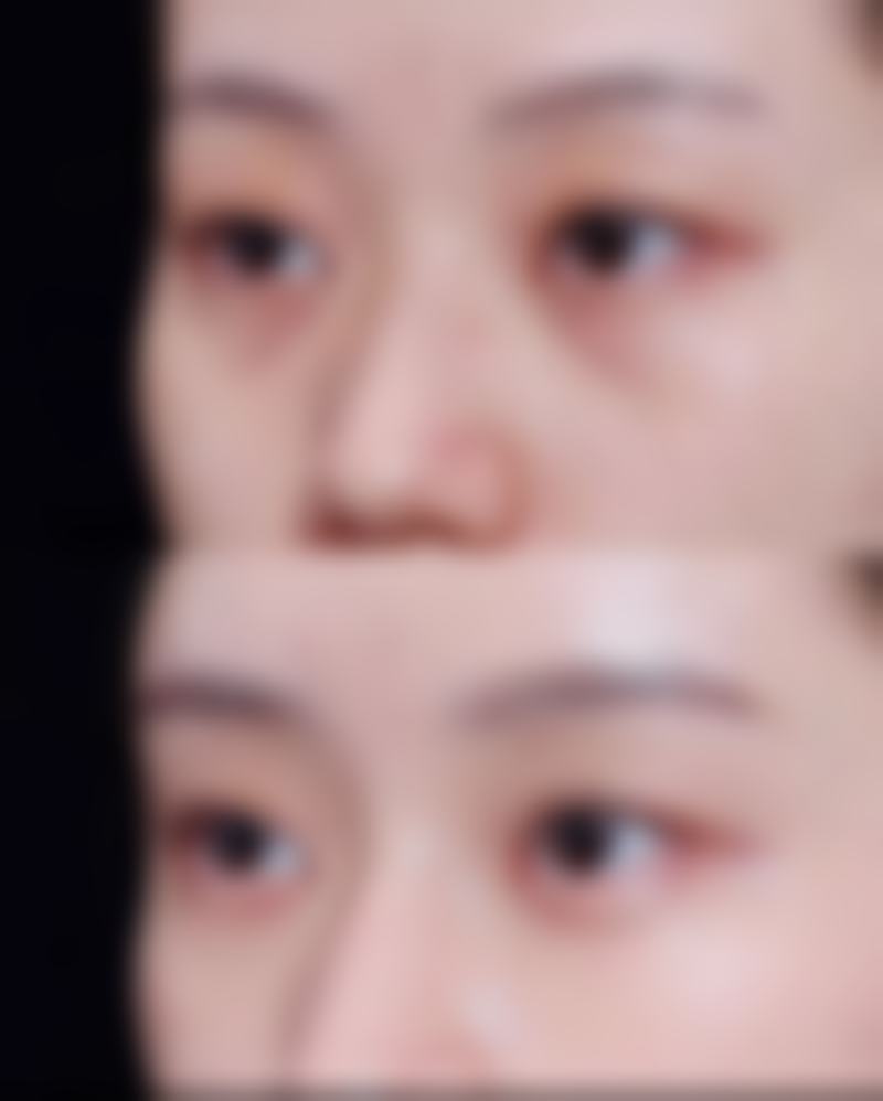 医生技术对削下颚骨手术风险的影响