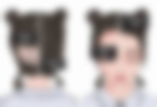 水凝胶注射隆胸成效可以维持多长时间