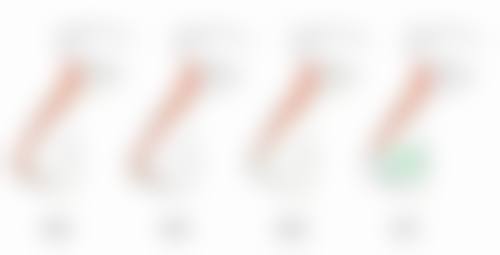 耳软骨隆鼻修复期后悔取出的情况