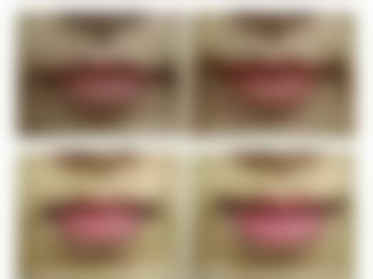 丰太阳穴会有生命危险吗