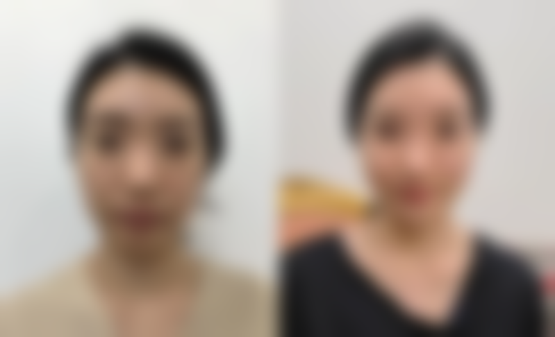 LeeJiham皮肤科医院 江南店医院技术好不好？