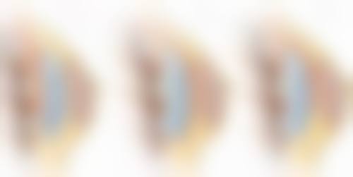 不做手术缩小阴唇的局限性