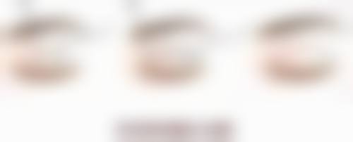 毛囊不够能用别人头发或其他部位毛发吗