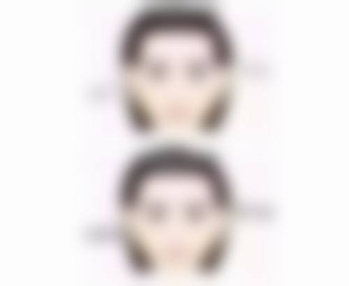 吸脂手术对未成年人健康的潜在风险