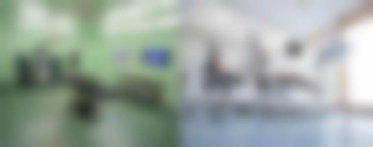 总结——北京圣嘉新医疗美容医院张笑天医生怎么样？