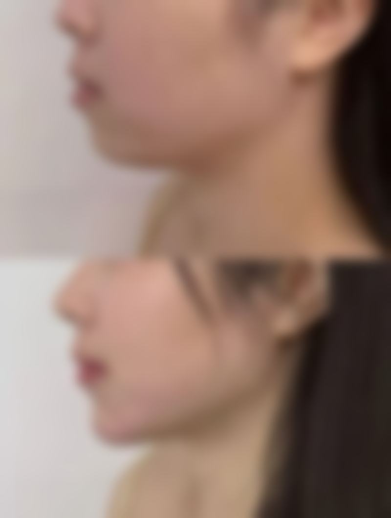 总结——东阳吴少珍医学美容诊所怎么样?