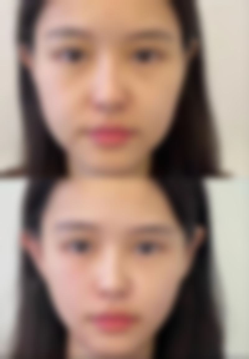 杭州仁术仁众医疗美容(旗舰店)口碑如何?