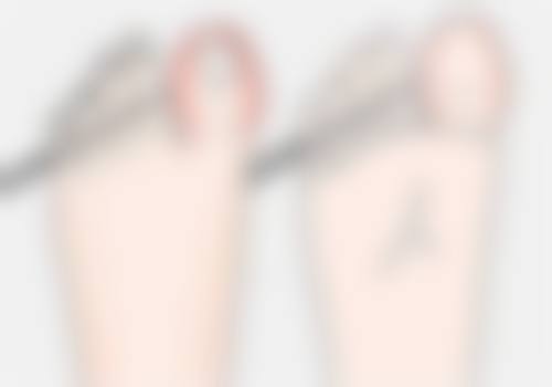 种植头发存活率是多少？正常80% - 95%，哪些因素会影响它呢 