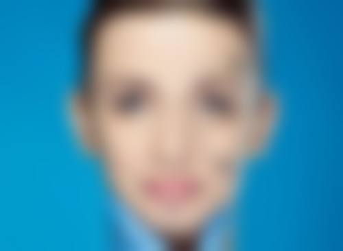 耳软骨隆鼻后不同阶段的修复情况