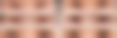 韩国大邱oblige整形外科电话号码及预约方法