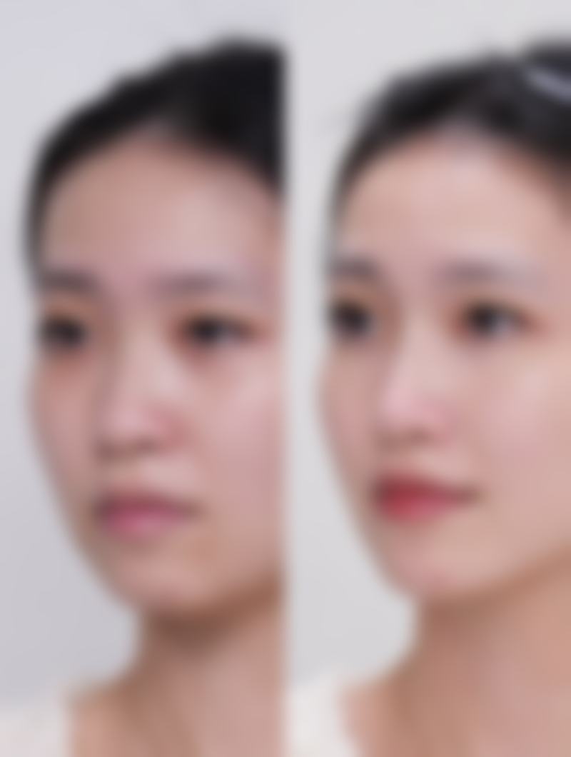 沈阳蓝天医疗整形美容医院医院技术好不好?
