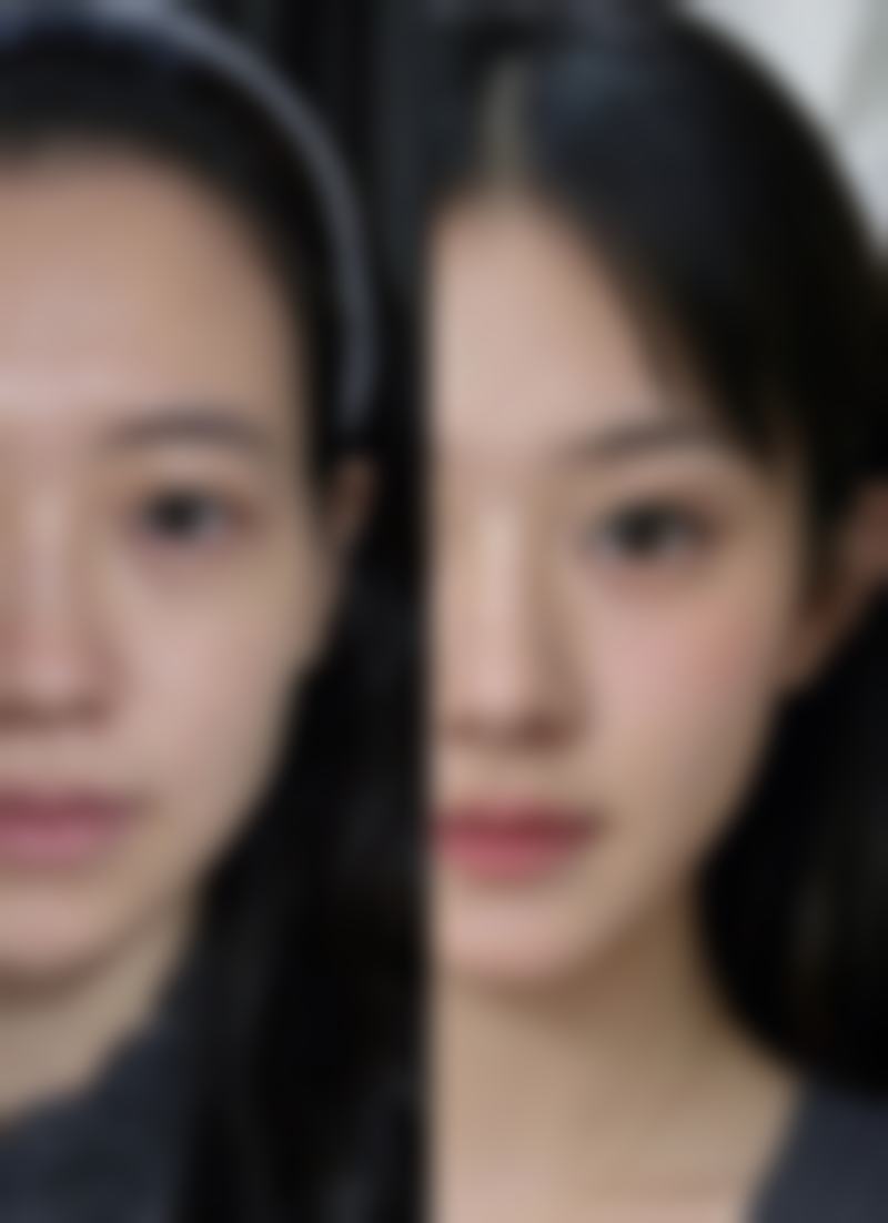 嘴巴整形后进食的注意事项