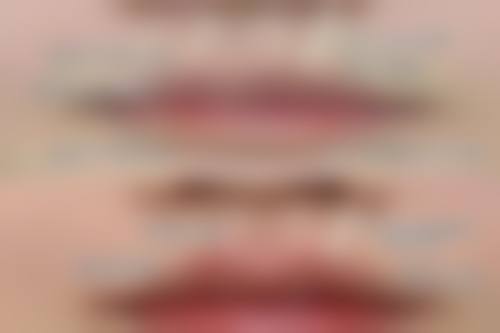 EH（爱护）整形外科口碑如何？