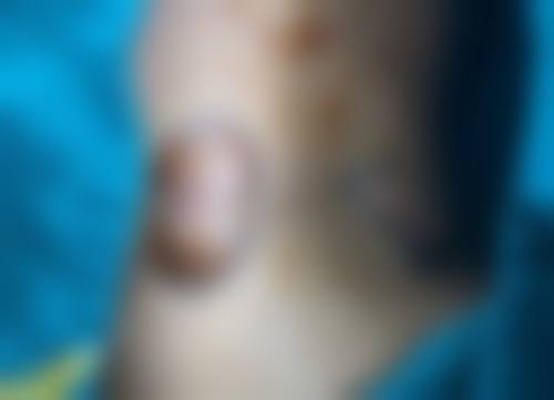 美白针成分的协同作用及成效