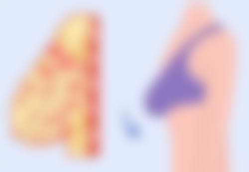 丰太阳穴会有危险吗？常见风险有哪些又该如何降低风险呢