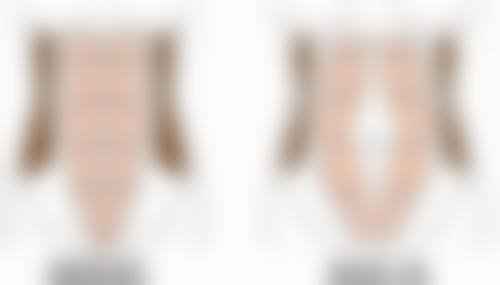 小阴唇缩小了是什么原因？或是年龄、疾病、生理、刺激、激素变化所致