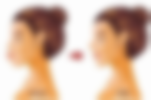 术后修复阶段的问题