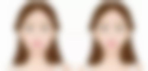 疾病因素引发小阴唇缩小