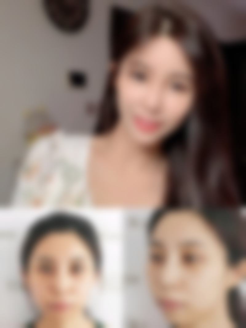 湖南安铂丽美尚医疗美容医院技术好不好？