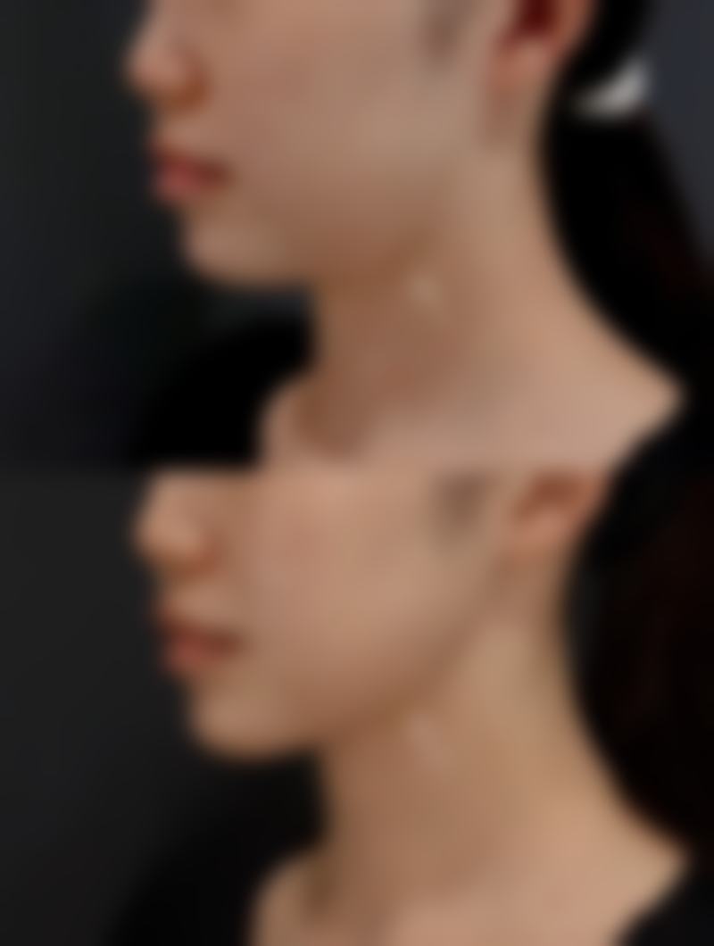 下颚骨方怎么矫正整容医院？多种矫正法及成都多家知名整容医院信息大揭秘