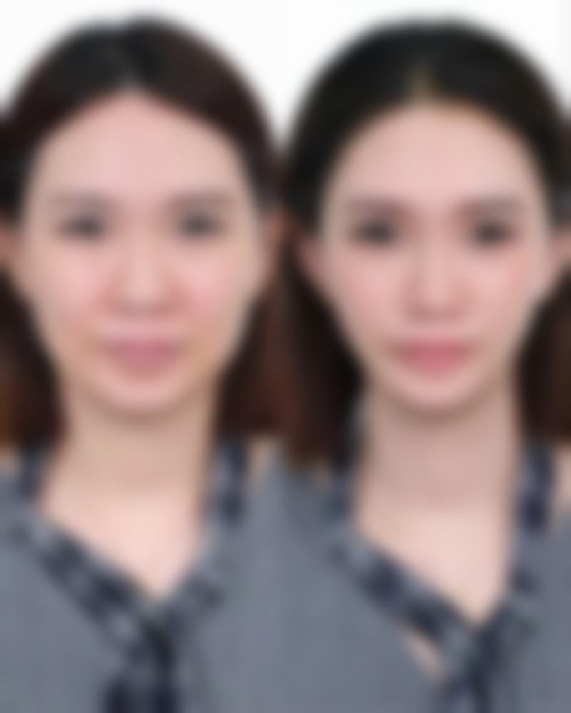 宁波市妇女儿童医院医学美容科医院技术好不好?
