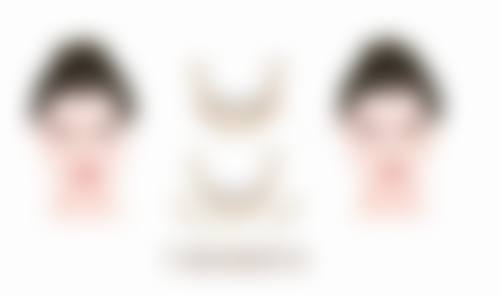 整容下颚骨造成的呼吸道梗阻风险