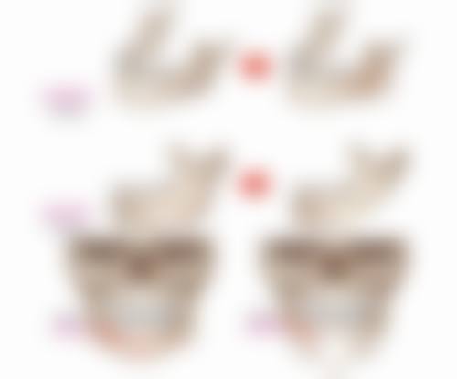 做阴道紧缩手术要注意什么