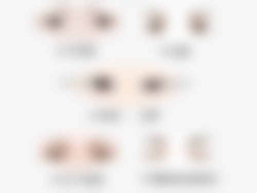 血肿与血清肿带来修复困扰