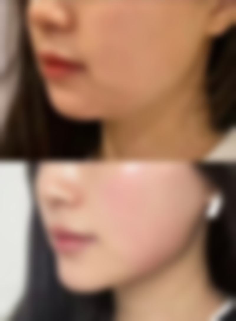 按摩棒消除眼袋的总结与建议