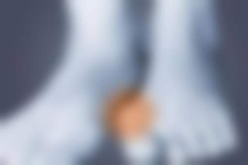 不同类型阴道紧缩手术的成效