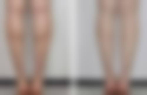 台州新凤凰医学整形美容医院白承根医生口碑评价如何?