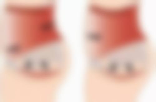 武汉斯启诺医美叶锋医生眼部整形技术怎么样?