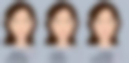 丰太阳穴对身体有害吗？常见方法、潜在危害及降低风险选医院攻略大揭秘