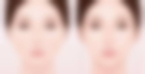 物理治疗去除长期眼袋的方法