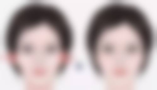 总结——哈尔滨市第一医院李鑫恒医生怎么样？