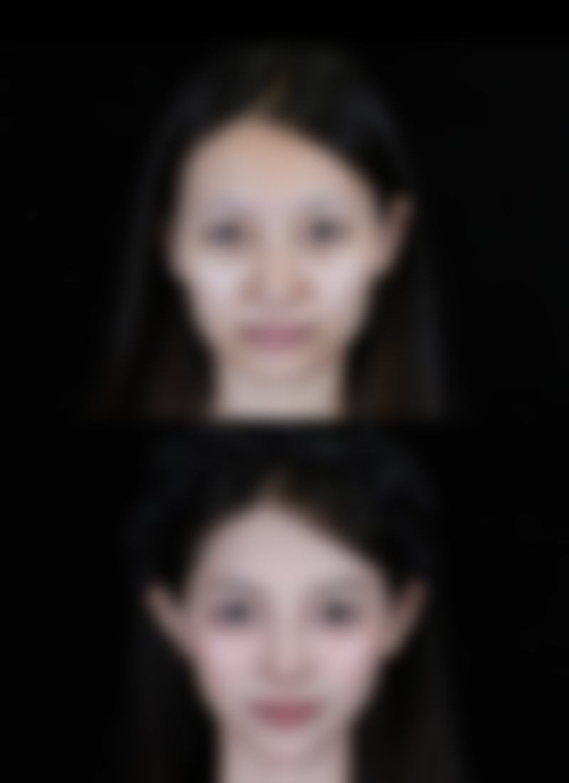 总结——香港全之研医学美容中 心All Beauty怎么样？