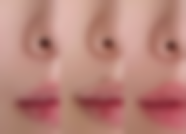 台州新凤凰医学整形美容医院白承根医生挂号预约攻略