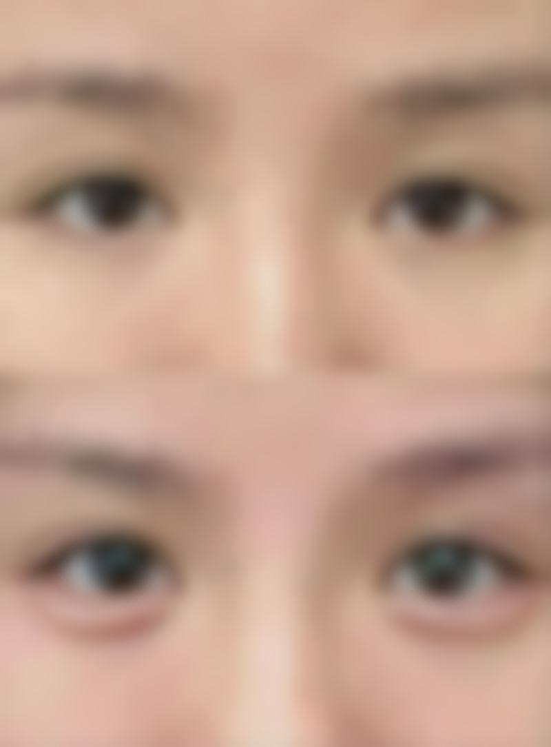 香港全之研医学美容中 心All Beauty电话号码及预约方法