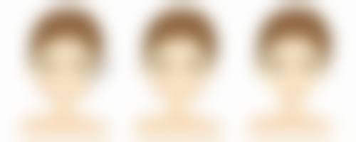 隆胸后乳房外观和触感的影响