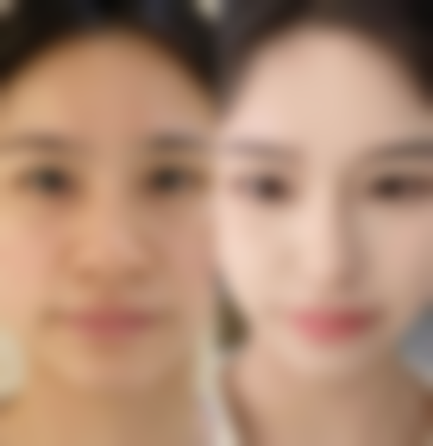 眉山皮肤病医院皮肤美容科口碑如何？