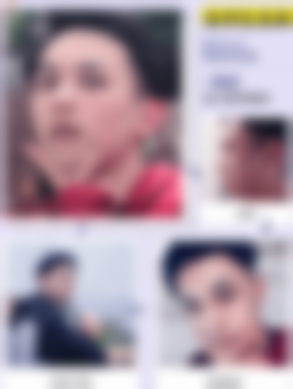 上海仁爱医院(整形科)查婷医生挂号预约攻略