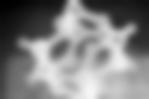 哪些人不适合做抽脂手术