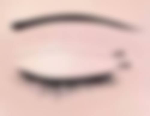 自体脂肪丰太阳穴能维持多久