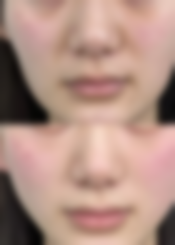 Lucia Clinic 神戸三宫口碑如何?