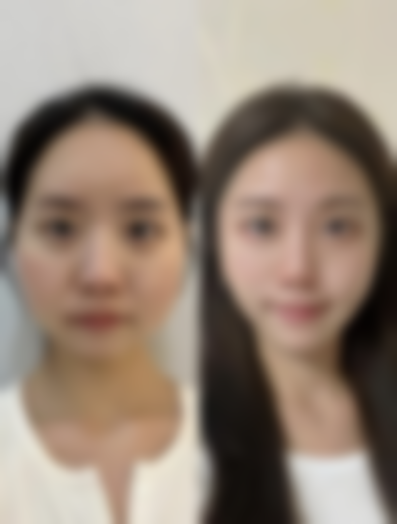 上海瑞妮丝医疗美容门诊部李煤医生技术好不好？