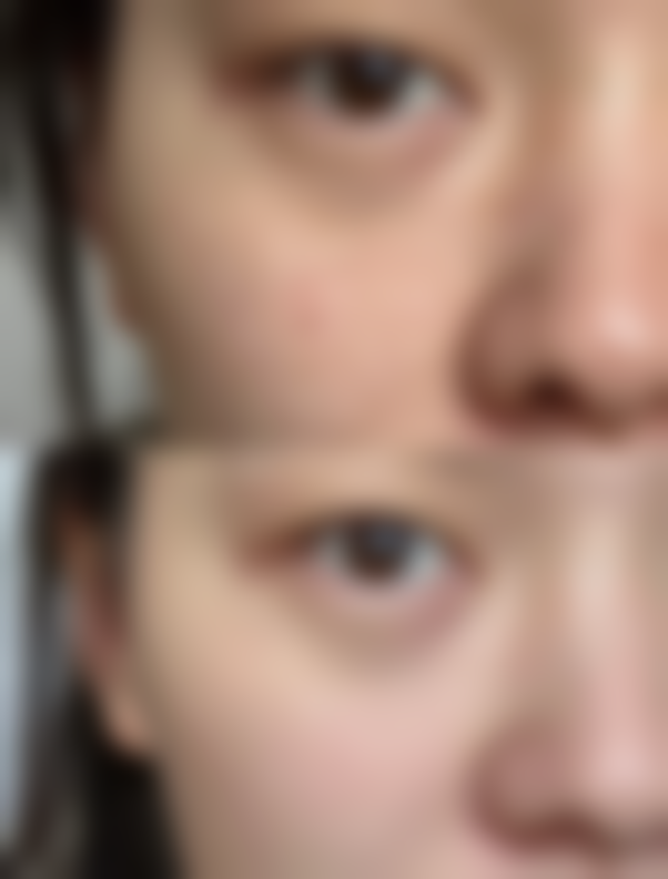 面部形态方面的弊端