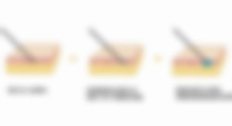 广州高尚医学美容中 心开展项目及价格