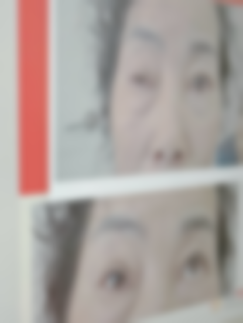 超声波祛眼袋的价格怎么样